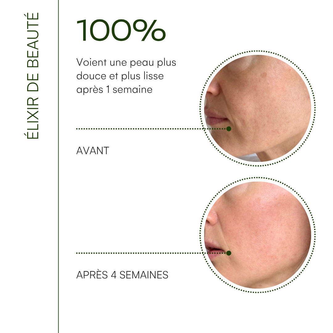 Éixir de beauté