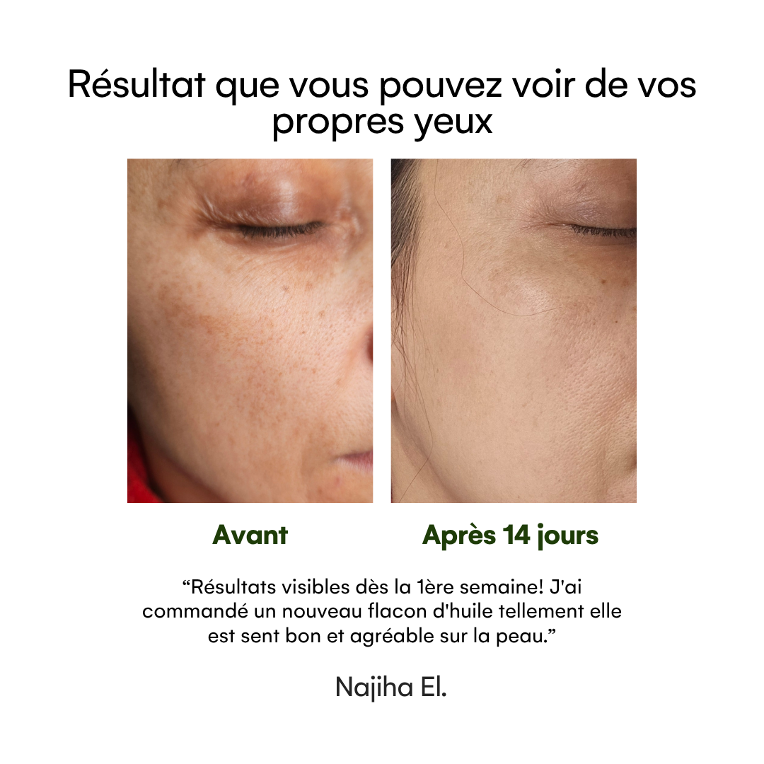 Éixir de beauté