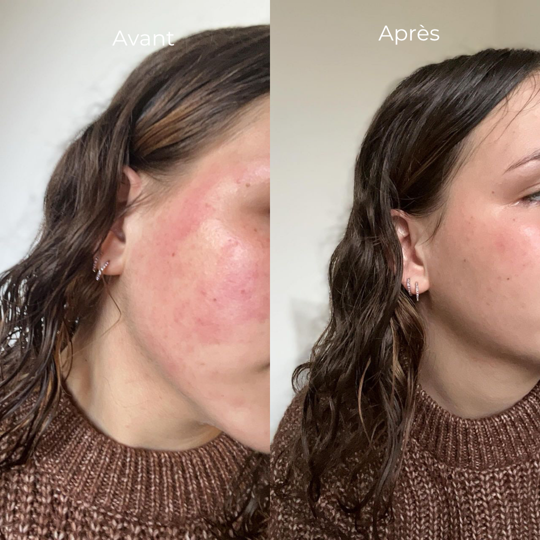Routine anti-imperfections
